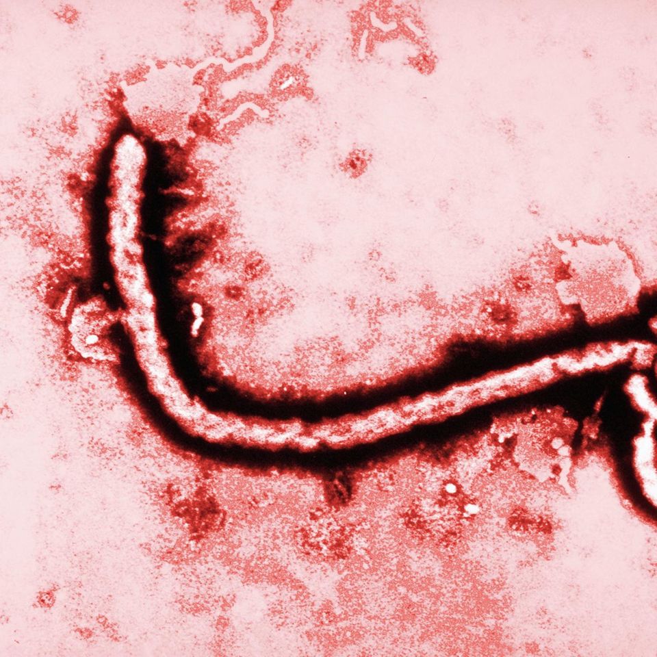 Ebola-Virus