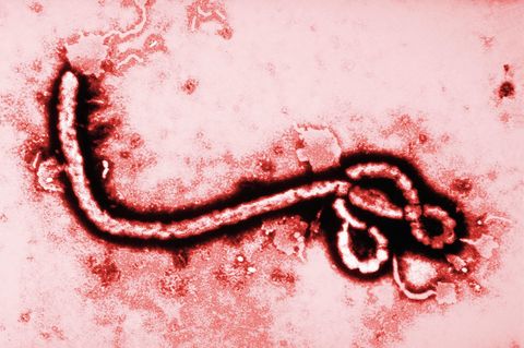 Ebola-Virus