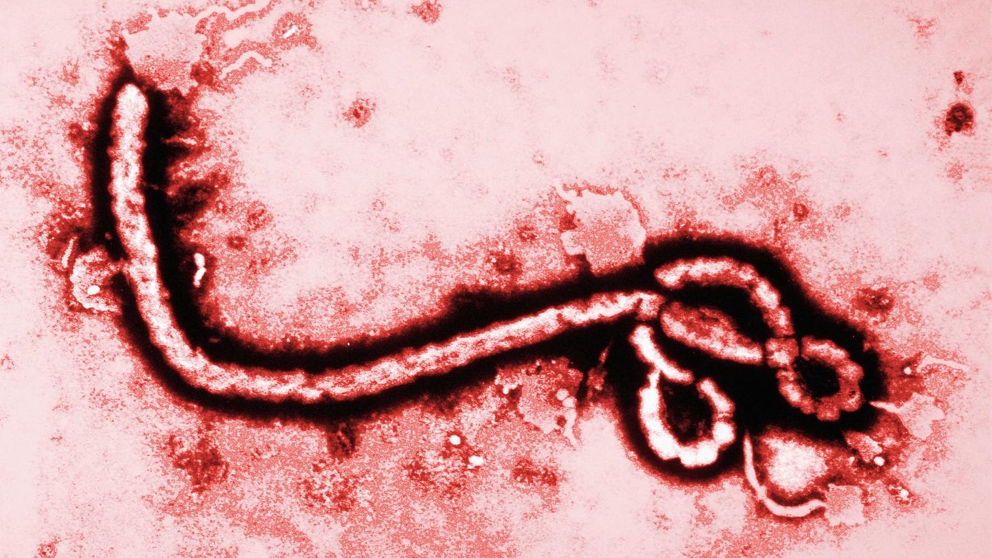Ebola-Virus