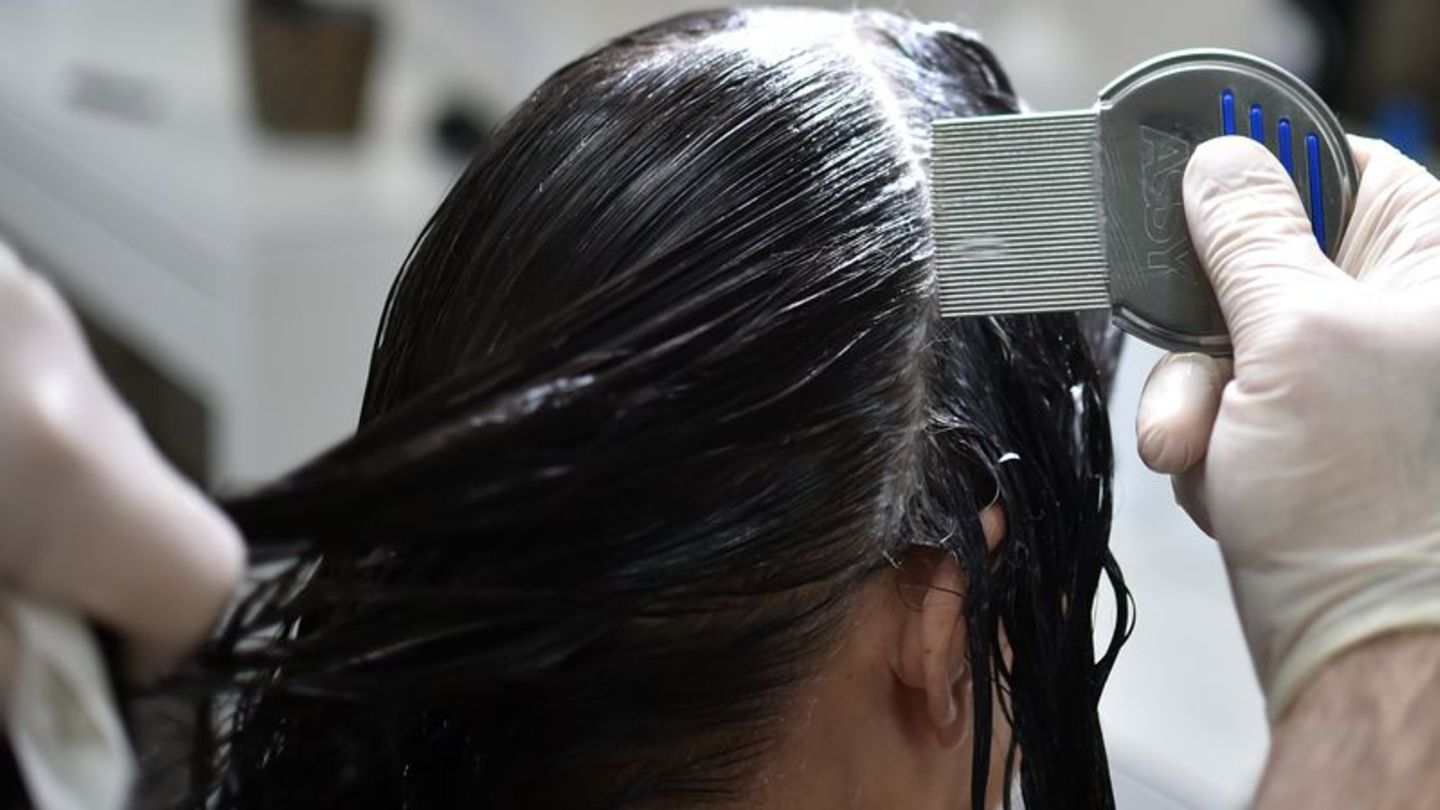 Gründliche Untersuchung ist entscheidend: Mit einem Läusekamm und einer Haarspülung lassen sich Läuse und Eier im feuchten Haar