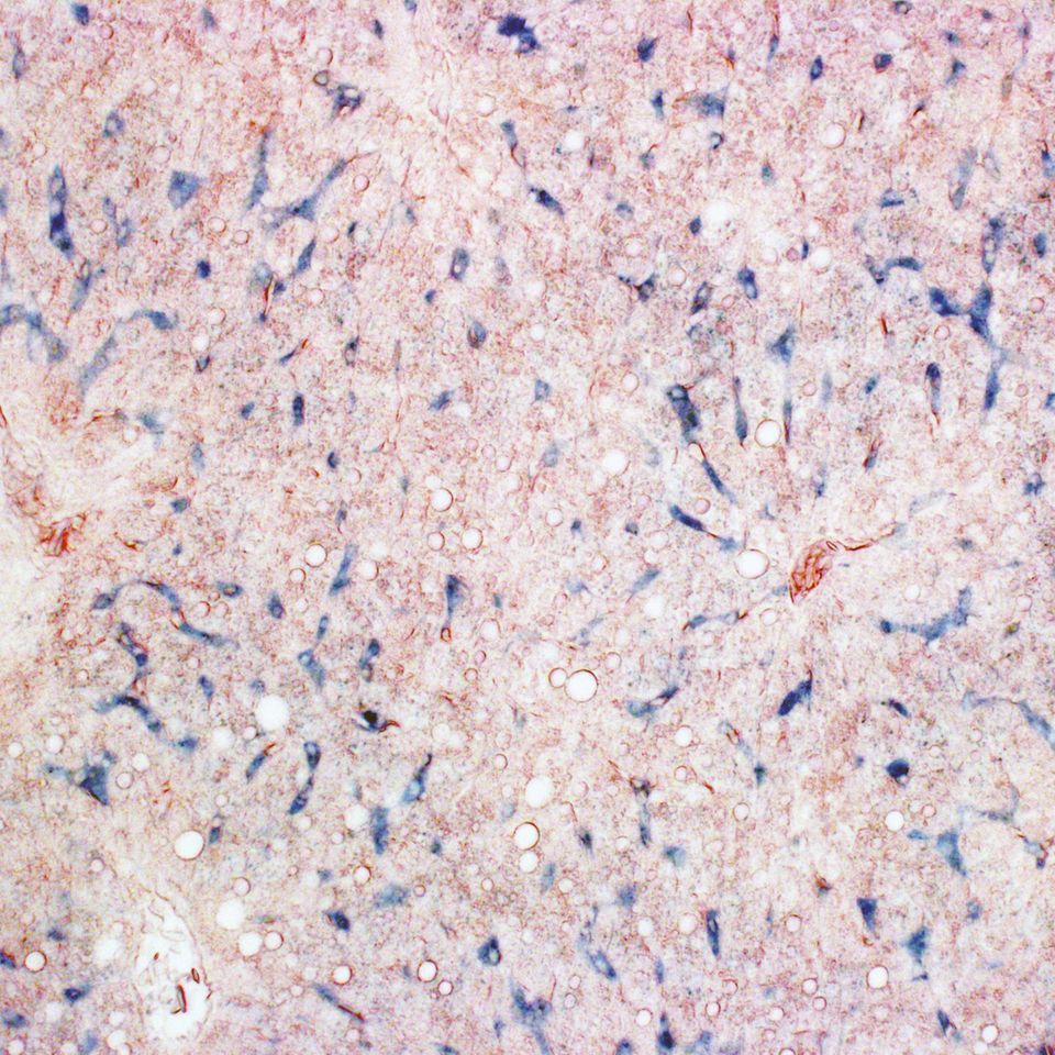 Histologisches Bild von Taubenlebergewebe